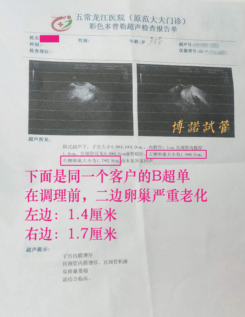 新加坡借卵成功率.jpg