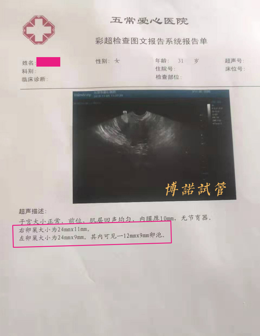 新加坡借卵费用.jpg