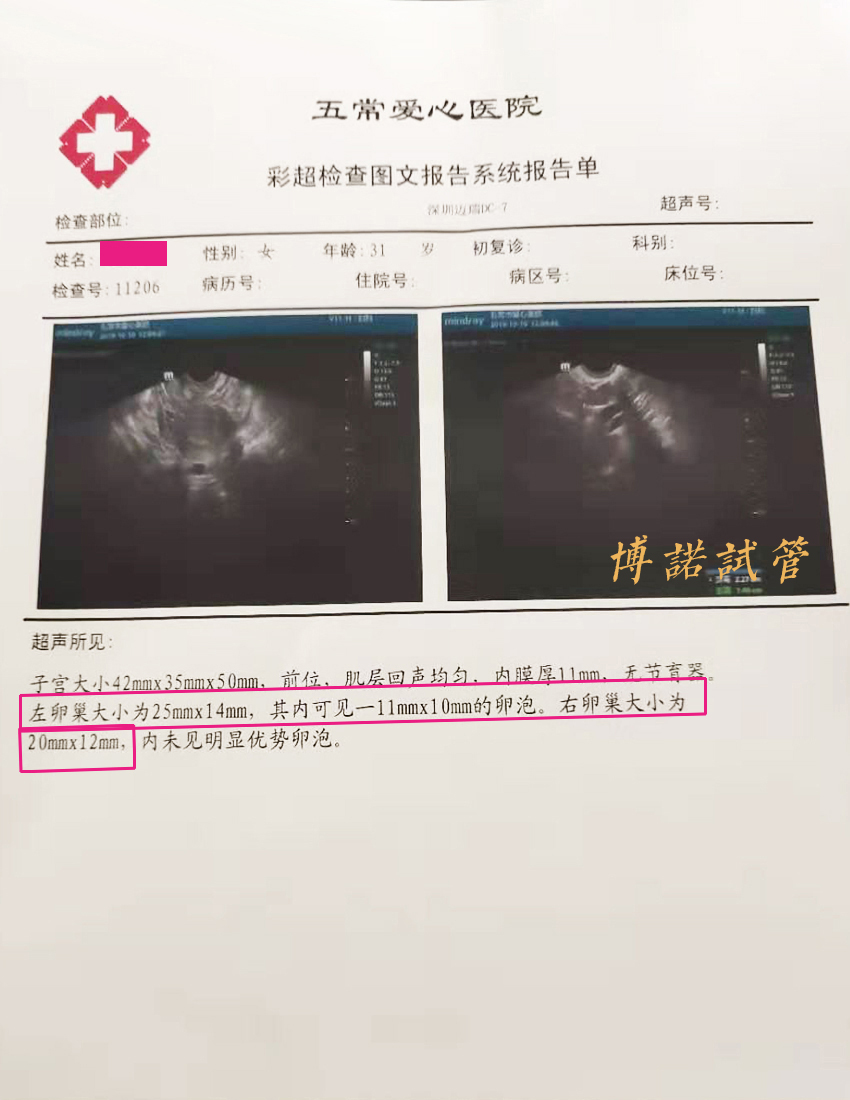 新加坡借卵生子.jpg