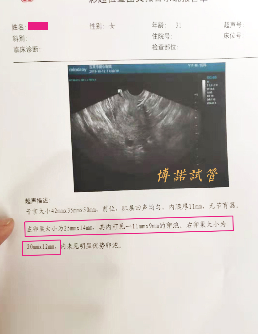 新加坡借卵试管医院.jpg