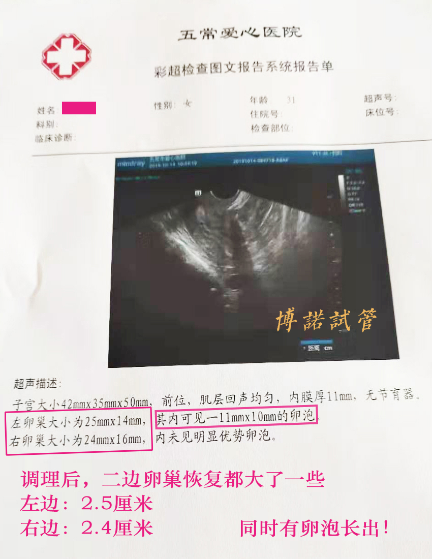 新加坡借卵怀孕经历.jpg