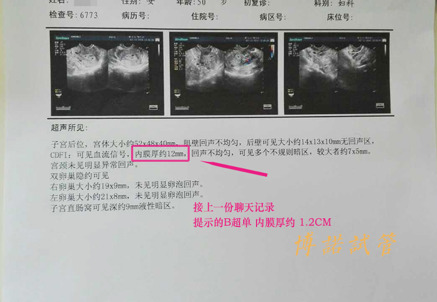 新加坡借卵助孕流程.jpg