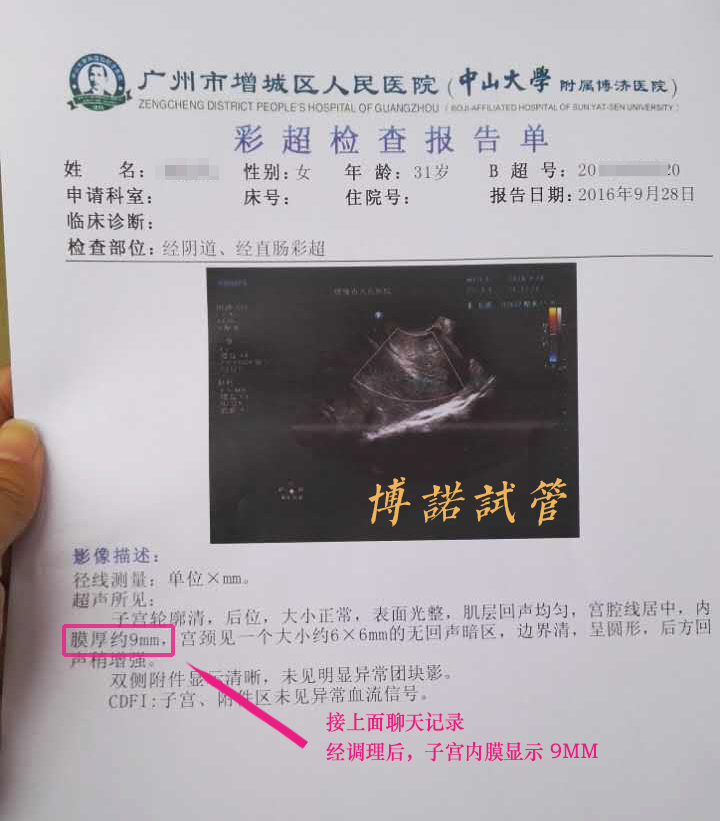 新加坡借卵试管婴儿费用.jpg