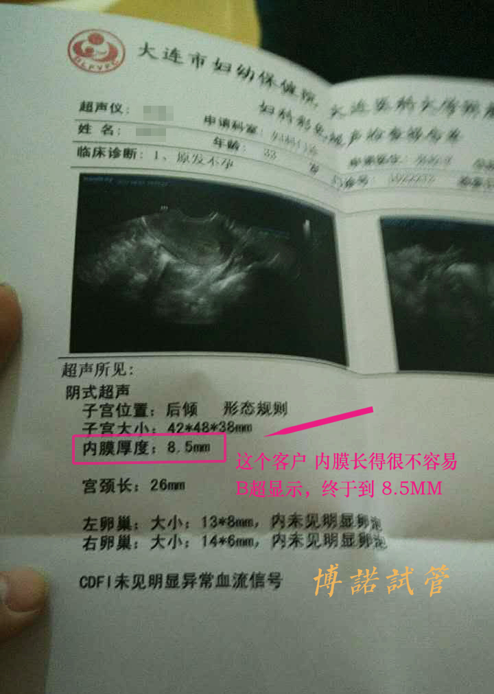 新加坡借卵试管婴儿.jpg