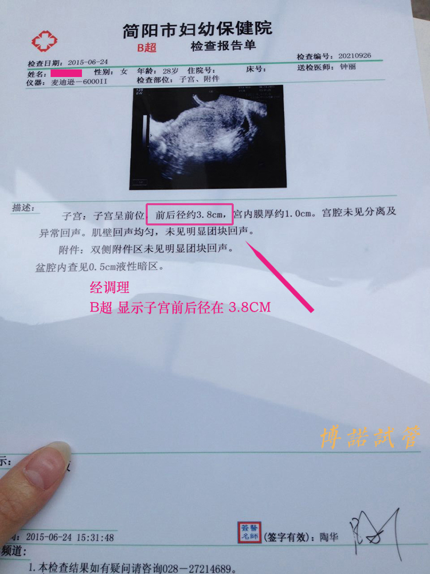 新加坡借卵试管医院.jpg