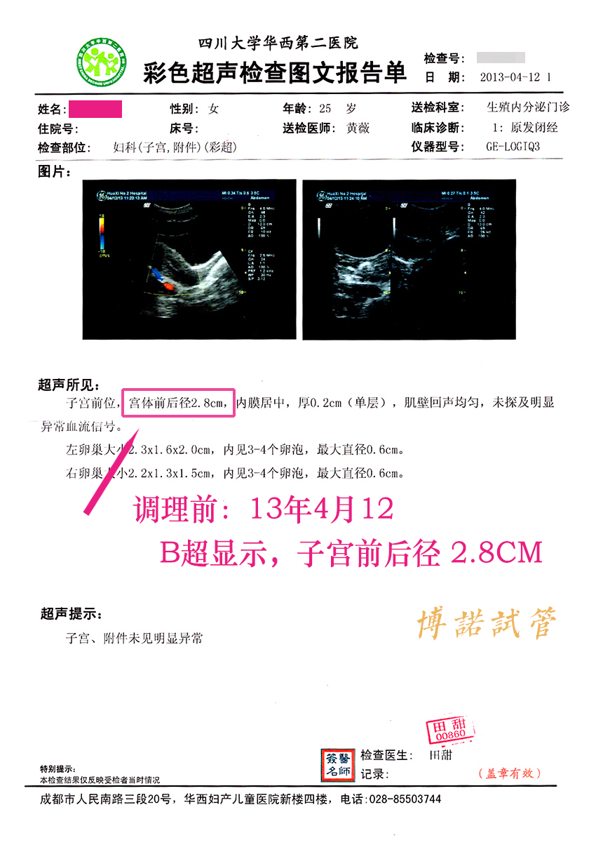 新加坡借卵试管.jpg